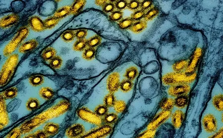 Distrito de Salud de Chesterfield provee cinco consejos para protegerte de la gripe aviar