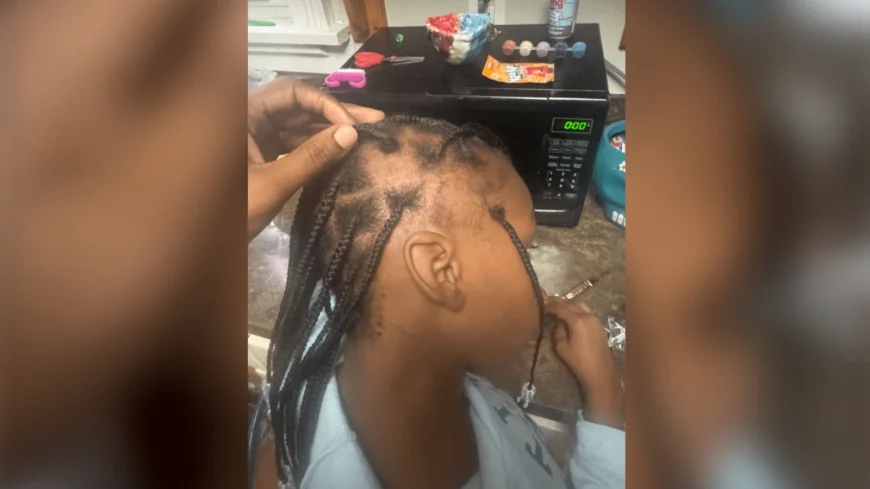Mother says daughter’s hair was pulled out by another student at Fox Elementary